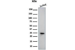 Western Blot Analysis of human Jurkat Cell lysate using CD3e Mouse Monoclonal Antibody (PC3/188A). (CD3 epsilon Antikörper  (Cytoplasmic Domain))