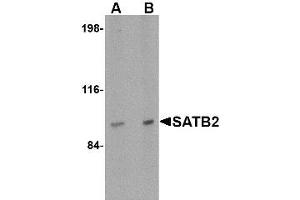 Image no. 1 for anti-SATB Homeobox 2 (SATB2) (N-Term) antibody (ABIN1494405) (SATB2 Antikörper  (N-Term))