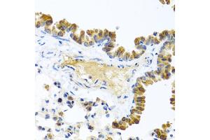 Immunohistochemistry of paraffin-embedded mouse lung using WNT9A antibody. (WNT9A Antikörper)