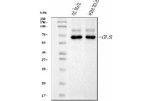 Western blot analysis of Glutaminase/GLS using anti-Glutaminase/GLS antibody (ABIN7601601).