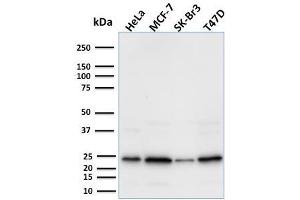 Western Blot Analysis using Mouse Mammaglobin-Monospecific Monoclonal Antibody (MGB1/2000). (Mammaglobin A Antikörper)