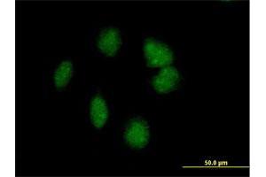 Immunofluorescence of purified MaxPab antibody to POMC on HeLa cell. (POMC Antikörper  (AA 1-267))