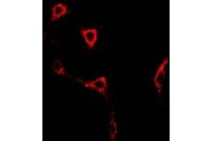 Immunofluorescent analysis of GLUR6 staining in U2OS cells. (GRIK2 Antikörper)