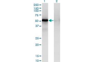 Western Blot analysis of MAPKAPK5 expression in transfected 293T cell line by MAPKAPK5 monoclonal antibody (M02), clone 3D7. (MAPKAP Kinase 5 Antikörper  (AA 371-471))