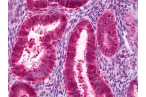 Anti-PCK1 antibody IHC of human uterus, endometrium. (PCK1 Antikörper)
