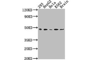 Western Blot Positive WB detected in: 293 whole cell lysate, HepG2 whole cell lysate, Hela whole cell lysate, K562 whole cell lysate, Rat brain tissue All lanes: FNTB antibody at 1:2000 Secondary Goat polyclonal to rabbit IgG at 1/50000 dilution Predicted band size: 49, 44 kDa Observed band size: 49 kDa