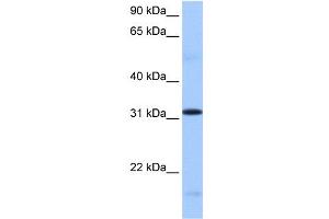 WB Suggested Anti-FUSIP1 Antibody Titration:  0. (SRSF10 Antikörper  (C-Term))