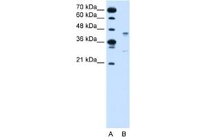 WB Suggested Anti-GPR161 Antibody Titration:  0. (GPR161 Antikörper  (Middle Region))