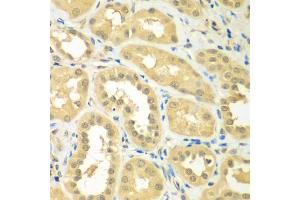 Immunohistochemistry of paraffin-embedded human kidney using RPS6KL1 antibody (ABIN5975299) at dilution of 1/100 (40x lens). (RPS6KL1 Antikörper)
