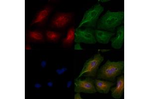 ABIN6259051 and ABIN6274992 staining  cells by IF/ICC. (Cep76 Antikörper  (Internal Region))
