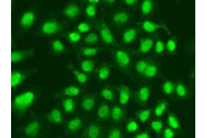 Immunofluorescence analysis of A549 cell using APTX antibody. (Aprataxin Antikörper)