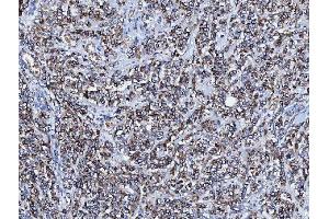 IHC analysis of CD166/ALCAM using anti-CD166/ALCAM antibody (ABIN5518801).