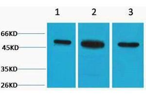 Western Blotting (WB) image for anti-Tubulin, beta 2A (TUBB2A) antibody (ABIN3178773) (TUBB2A Antikörper)