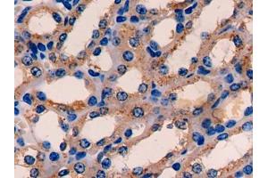 DAB staining on IHC-P; Samples: Mouse Kidney Tissue (ETFA Antikörper  (AA 34-295))