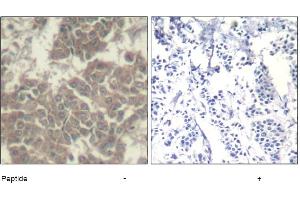 Image no. 1 for anti-Janus Kinase 2 (JAK2) (Tyr570) antibody (ABIN319397) (JAK2 Antikörper  (Tyr570))