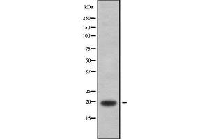 Western blot analysis of MYLPF using HepG2 whole cell lysates (MYLPF Antikörper  (C-Term))