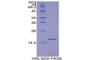 SDS-PAGE (SDS) image for S100 Protein (S100) (AA 1-94) protein (His tag) (ABIN1171302) (S100 Protein (S100) (AA 1-94) protein (His tag))