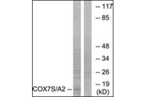 Western blot analysis of extracts from rat heart cells, using COX7S/A2 Antibody.