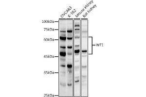 Western blot analysis of extracts of various cell lines, using WT1 antibody (ABIN3021697, ABIN3021698, ABIN3021699, ABIN1513692 and ABIN6215537) at 1:1000 dilution. (WT1 Antikörper  (AA 1-302))