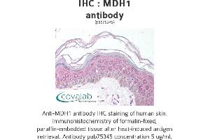 Image no. 1 for anti-Malate Dehydrogenase 1, NAD (Soluble) (MDH1) antibody (ABIN1736856) (MDH1 Antikörper)