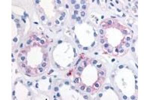 Immunohistochemistry (IHC) image for anti-Epoxide Hydrolase 2, Cytoplasmic (EPHX2) (Internal Region) antibody (ABIN2469511) (EPHX2 Antikörper  (Internal Region))
