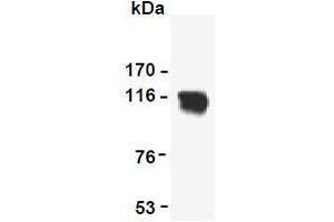 Western Blotting (WB) image for anti-Reversion-Inducing-Cysteine-Rich Protein with Kazal Motifs (RECK) (AA 621-832) antibody (ABIN1108847)