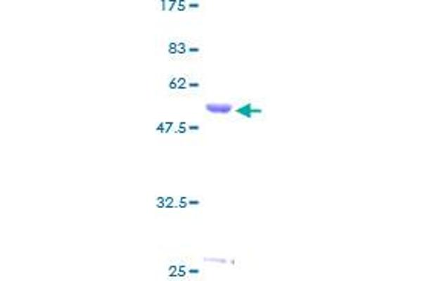 HLA-DMA Protein (AA 1-261) (GST tag)