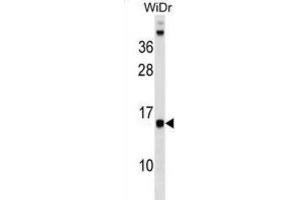 Western Blotting (WB) image for anti-Defender Against Cell Death 1 (DAD1) antibody (ABIN2999454) (DAD1 Antikörper)