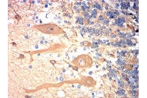 Immunohistochemical analysis of paraffin-embedded cerebellum tissues using TUBB3 mouse mAb with DAB staining. (TUBB3 Antikörper)