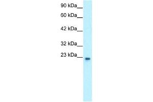 Human HepG2; WB Suggested Anti-GTF2F2 Antibody Titration: 0. (GTF2F2 Antikörper  (Middle Region))