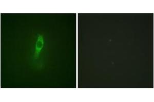 Immunofluorescence analysis of NIH-3T3 cells, using ETK (Phospho-Tyr40) Antibody. (BMX Antikörper  (pTyr40))