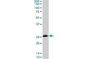 Western Blotting (WB) image for anti-Ring Finger Protein 141 (RNF141) (AA 141-230) antibody (ABIN599236) (RNF141 Antikörper  (AA 141-230))