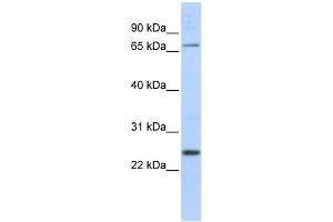 WB Suggested Anti-BC37295_3 Antibody Titration:  0. (ZNF835 Antikörper  (Middle Region))