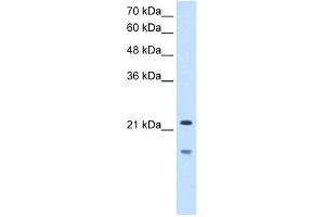 WB Suggested Anti-MMP7 Antibody Titration:  2. (MMP7 Antikörper  (C-Term))