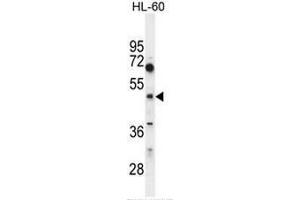 CEPT1 Antibody (N-term) western blot analysis in HL60 cell line lysates (35µg/lane). (CEPT1 Antikörper  (N-Term))
