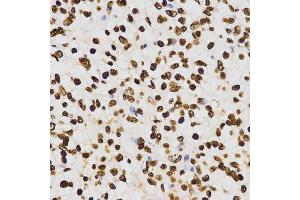 Immunohistochemistry (IHC) image for anti-Histone H3 (H3) (H3K27me) antibody (ABIN3023266) (Histone 3 Antikörper  (H3K27me))