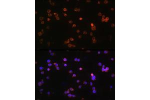 Immunofluorescence analysis of Jurkat cells using P2RX5 Rabbit pAb (ABIN6132450, ABIN6145117, ABIN6145118 and ABIN6215403) at dilution of 1:100 (40x lens). (P2RX5 Antikörper  (AA 341-422))