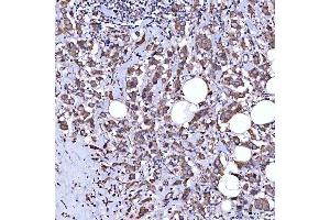 IHC analysis of RAB3GAP1 using anti-RAB3GAP1 antibody (ABIN7599702). (RAB3GAP1 Antikörper  (AA 109-810))