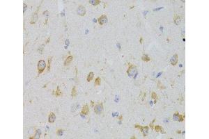 Immunohistochemistry of paraffin-embedded Mouse brain using KISS1R Polyclonal Antibody at dilution of 1:100 (40x lens). (KISS1R Antikörper)