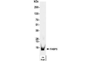 Western Blotting (WB) image for anti-Fatty Acid Binding Protein 3, Muscle and Heart (FABP3) antibody (ABIN7795612)