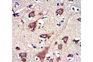 |Immunohistochemistry of paraffin-embedded human brain cancer tissue using GSNantibody. (Gelsolin Antikörper  (C-Term))