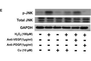 Western Blotting (WB) image for anti-Glyceraldehyde-3-Phosphate Dehydrogenase (GAPDH) antibody (ABIN2857072)