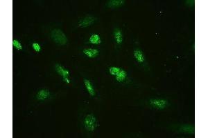 IF analysis of HMGB2 using anti-HMGB2 antibody (ABIN4886620).