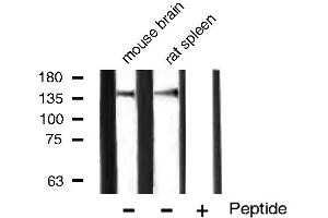 Western blot analysis of VEGFR1 expression in mouse brain and rat spleen tissue lysates,The lane on the right is treated with the antigen-specific peptide. (FLT1 Antikörper)