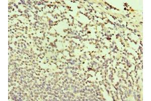 Immunohistochemistry of paraffin-embedded human small intestine tissue using ABIN7171996 at dilution of 1:100 (TXNDC11 Antikörper  (AA 656-985))