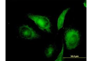 Immunofluorescence of monoclonal antibody to NIFUN on HeLa cell. (ISCU Antikörper  (AA 26-167))