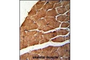 Immunohistochemistry (Paraffin-embedded Sections) (IHC (p)) image for anti-Coiled-Coil alpha-Helical Rod Protein 1 (CCHCR1) (AA 599-627) antibody (ABIN652467)