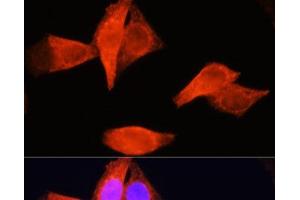 Immunofluorescence analysis of HeLa cells using PSAT1 Polyclonal Antibody at dilution of 1:100 (40x lens). (PSAT1 Antikörper)