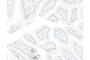 Immunohistochemistry (IHC) image for anti-Kruppel-Like Factor 4 (Gut) (KLF4) (AA 75-125) antibody (ABIN7795639)