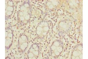 Immunohistochemistry of paraffin-embedded human colon tissue using ABIN7170174 at dilution of 1:100 (SLC23A2 Antikörper  (AA 1-90))